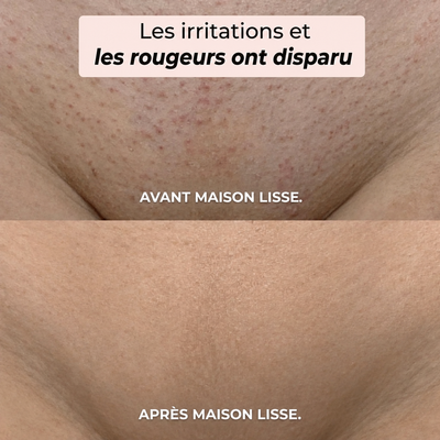 LE RITUEL LISSE ÉDITION 2 EN 1