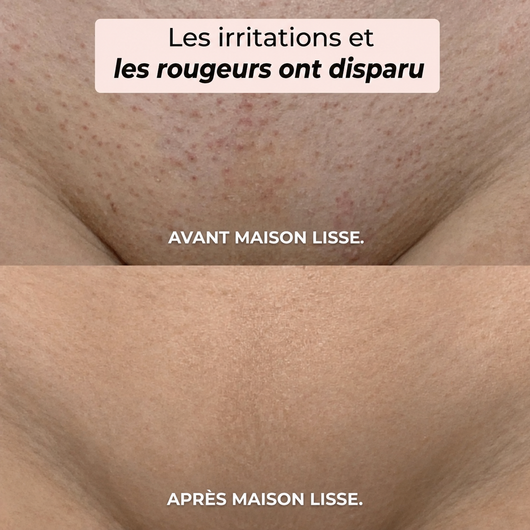 LE RITUEL LISSE ÉDITION 2 EN 1