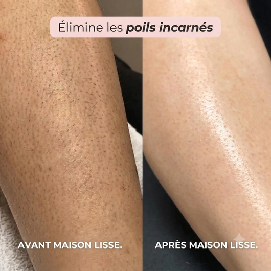 LE RITUEL LISSE ÉDITION 2 EN 1